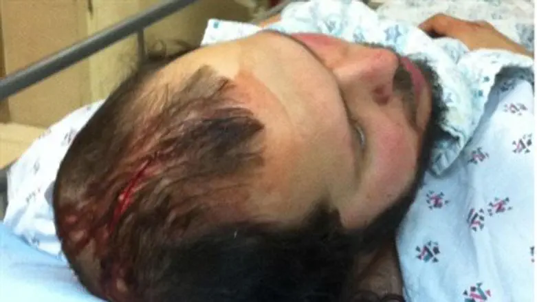 Даниэль Бронштейн в больнице