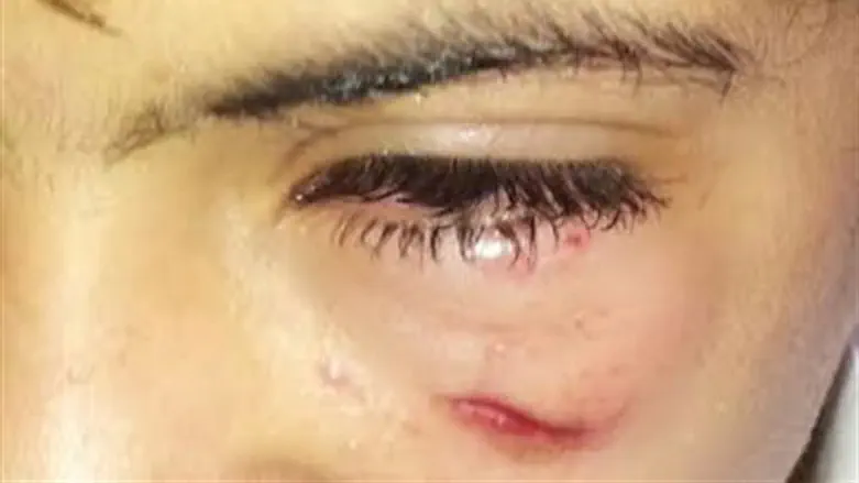 פגיעת הילד בתל אביב