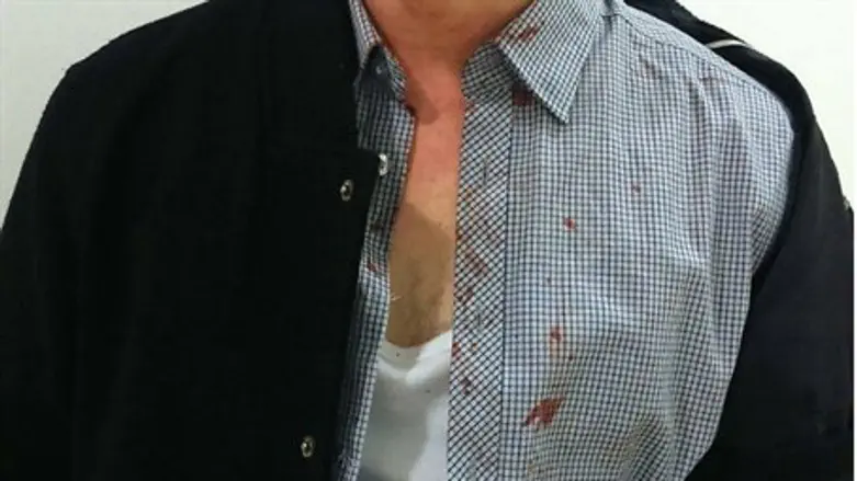 Hovav Engelsman after the attack