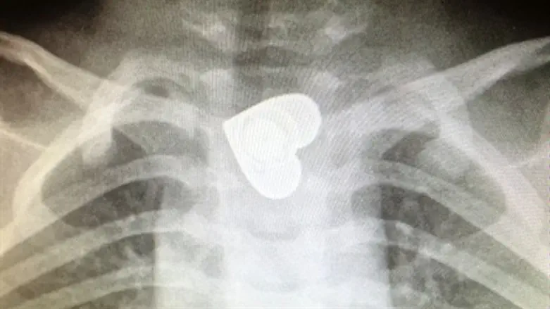 איך הגיע הלב?