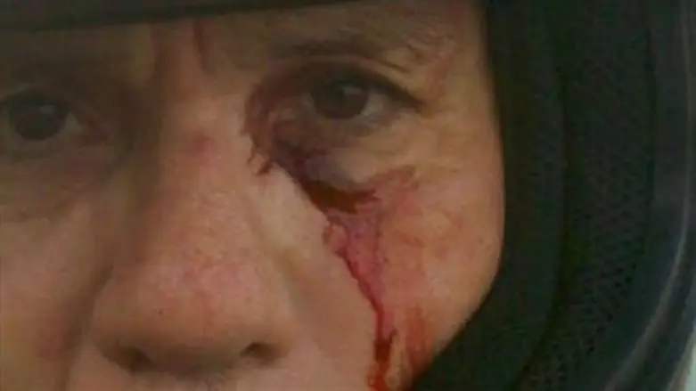 אלי אוחיון לאחר שהותקף