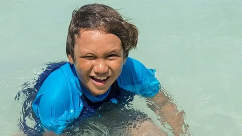 טיפול רפואי בים המלח לחולי פסוריאזיס