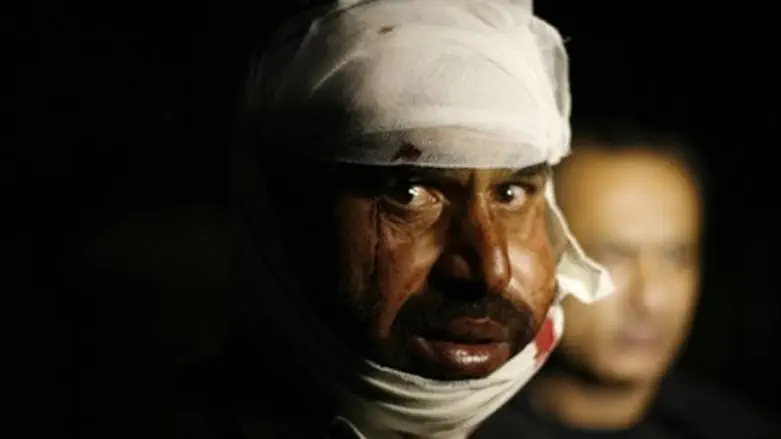 Injured Pakistani man