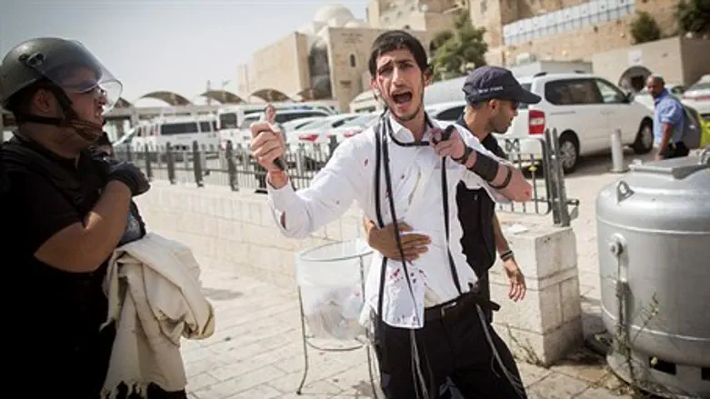 Young man attacked by Arabs