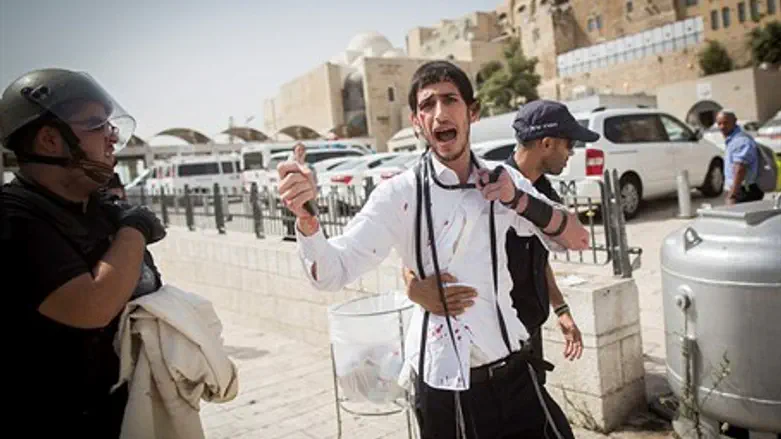 Исраэль Меир Нитай после нападения