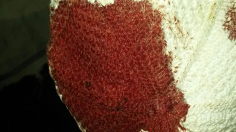 כיפה של אחד העצורים