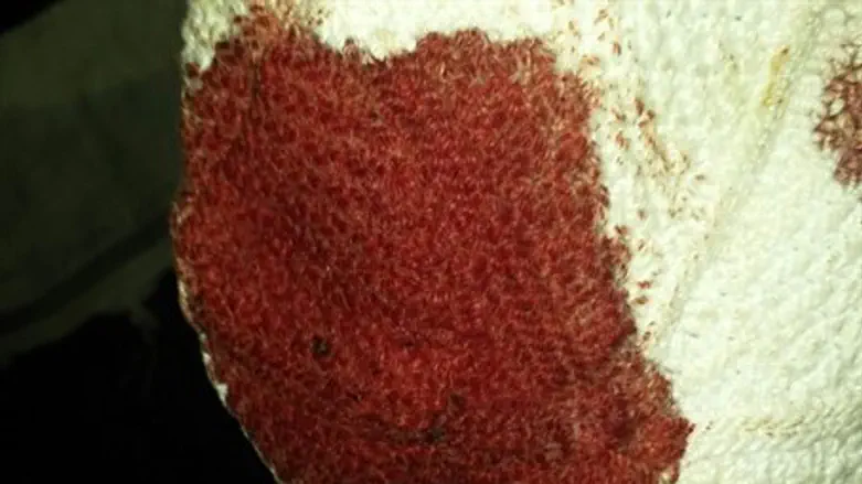 Кровь на кипе одного из избитых евреев