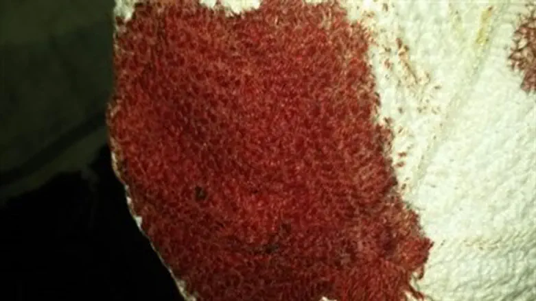 Bloodied kippah from a victim