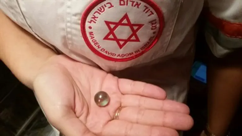 הגולה שנשלפה מקנה הנשימה