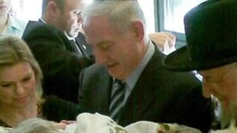 ברית המילה