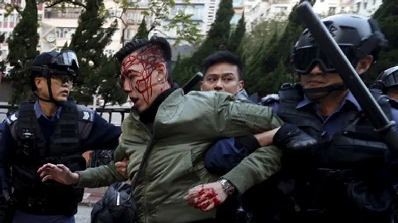 An unidentified injured man is escorted by riot police at Mongkok in Hong Kong
