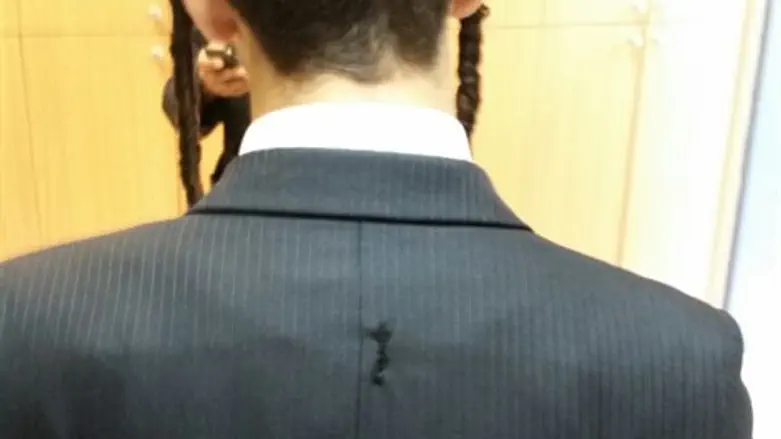 אחד הפצועים