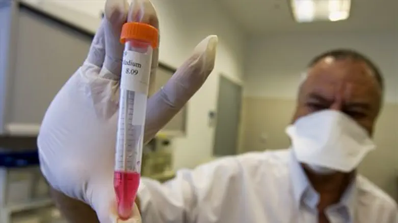 Test tube with mouth swab sample