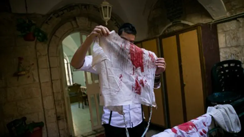 Одежда раненого в теракте харедим