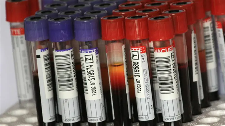 אילוסטרציה