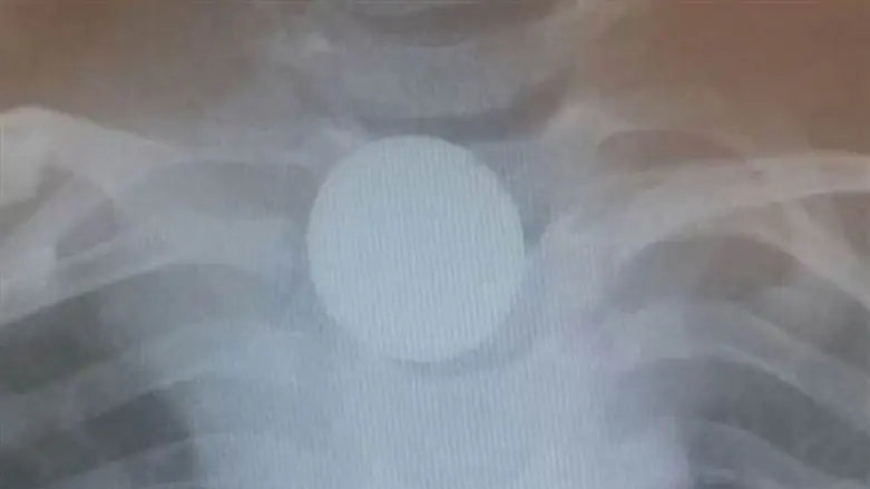 הדמיית הסוללה בוושט