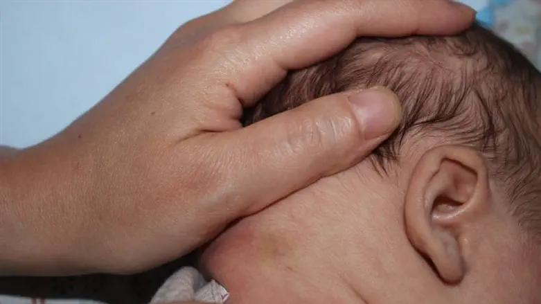 אזור העקיצה