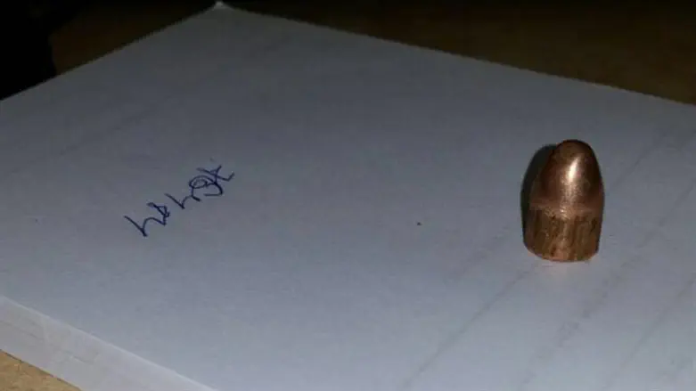 The bullet removed from the skull of a 77 year-old