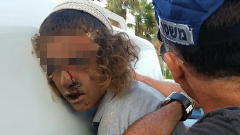 Teen wounded during arrest in Nahliel
