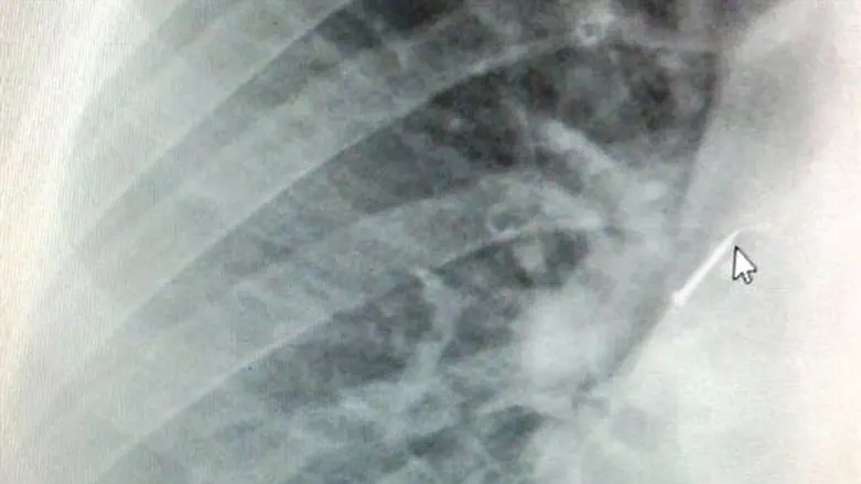 הנעץ לפני שנשלף