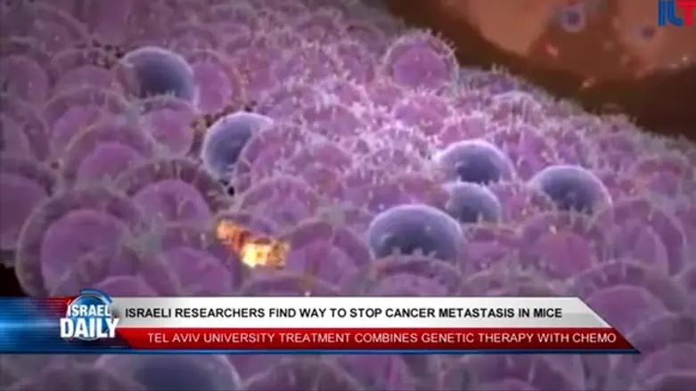 Israeli researchers find way to stop cancer metastasis in mice