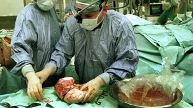 השתלת אברים