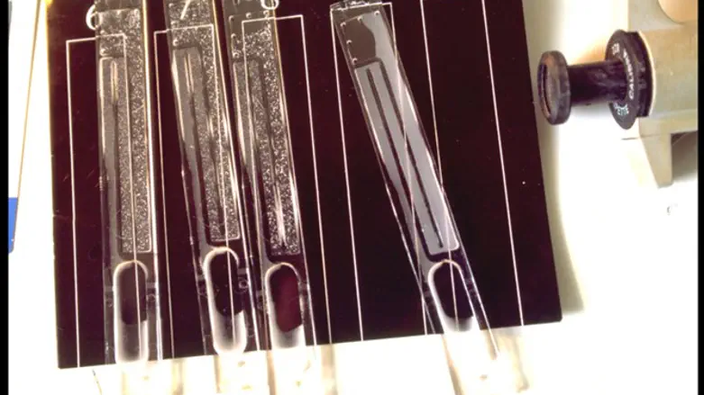 בדיקת איידס