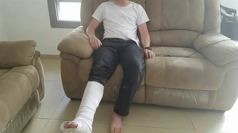 הנער ששבר את רגלו בעמונה