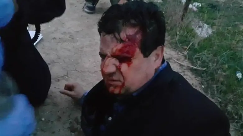 ח"כ עודה לאחר התקרית