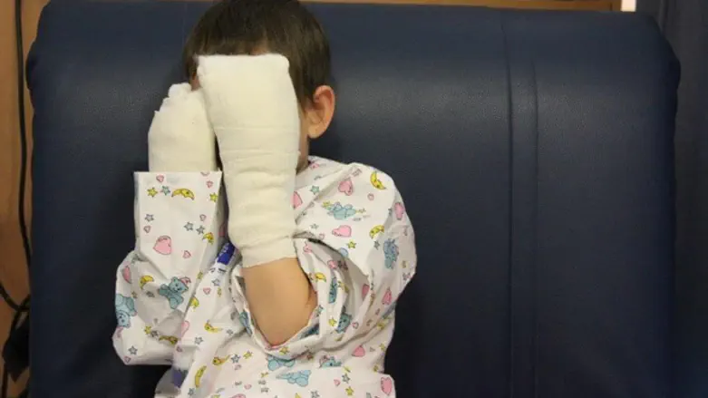 הילד וידיו החבושות