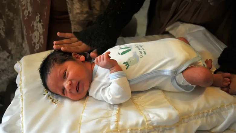 ברית מילה, אילוסטרציה