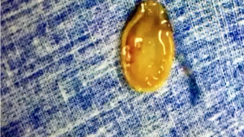 The extracted watermelon seed