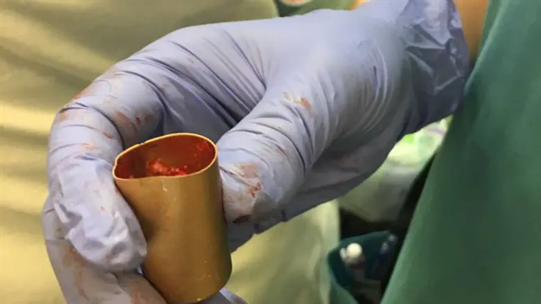 הפקק שבלע התינוק