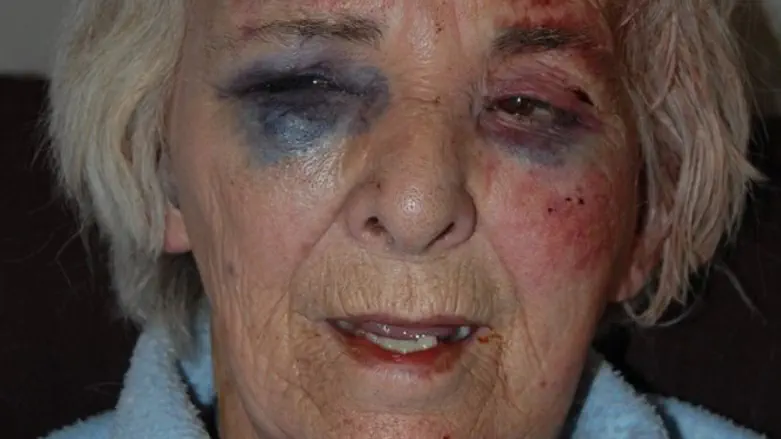 Catherine Smith, after the attack