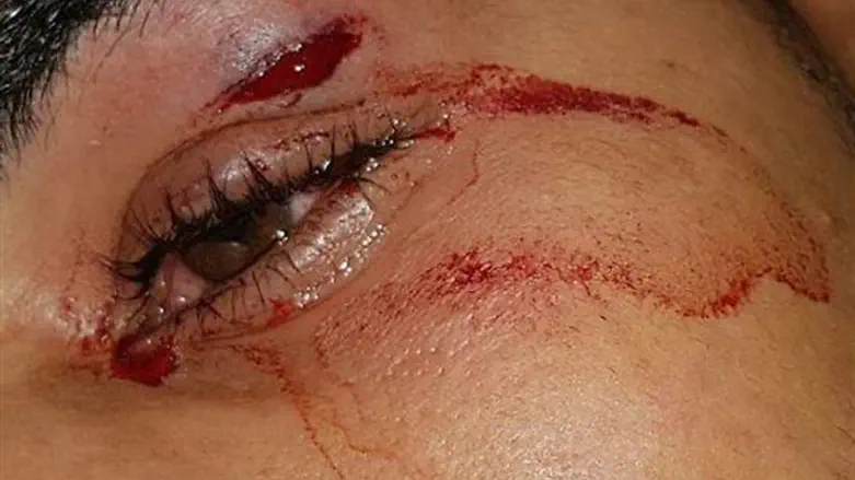 One of the soldier's faces