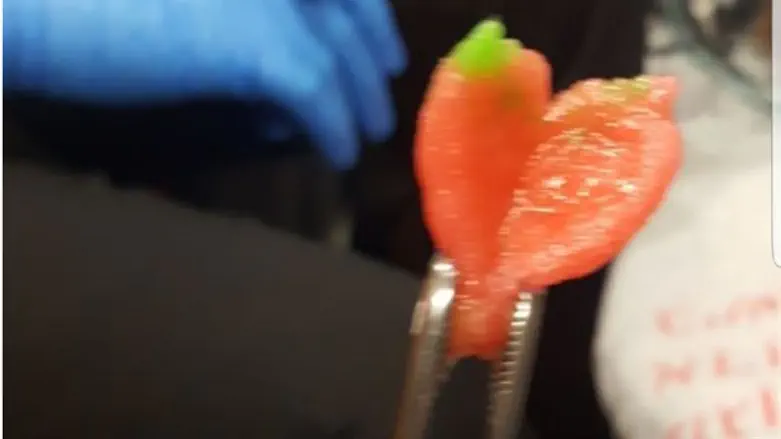 הסוכרייה שחולצה