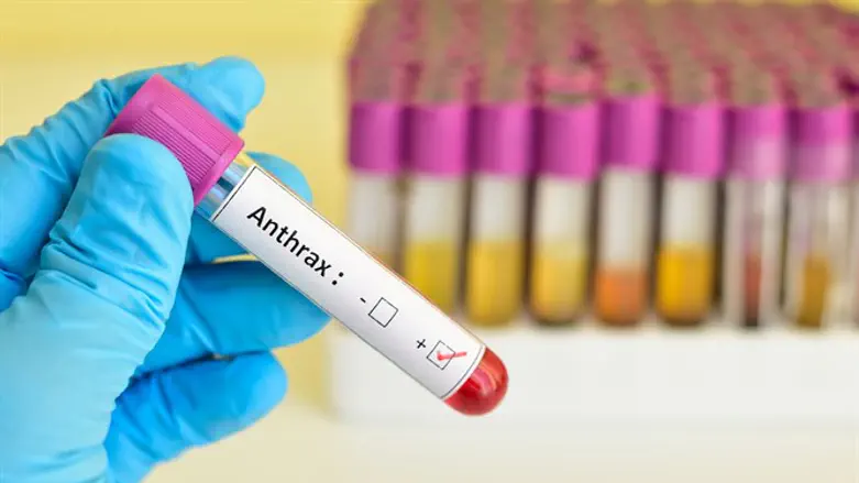 Anthrax