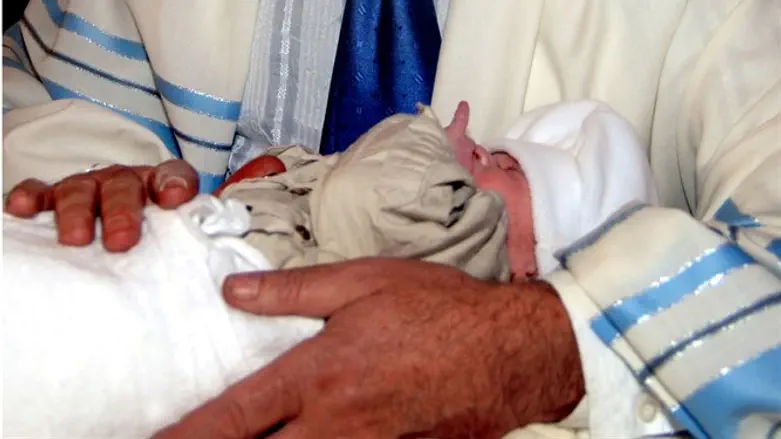 Circumcision (illustrative)