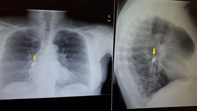 ראש המקדח בריאות האישה