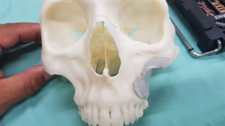 גולגלת אקריליק שהודפסה במדפסת תלת מימד