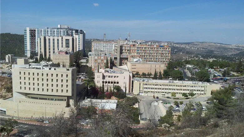 הדסה עין כרם