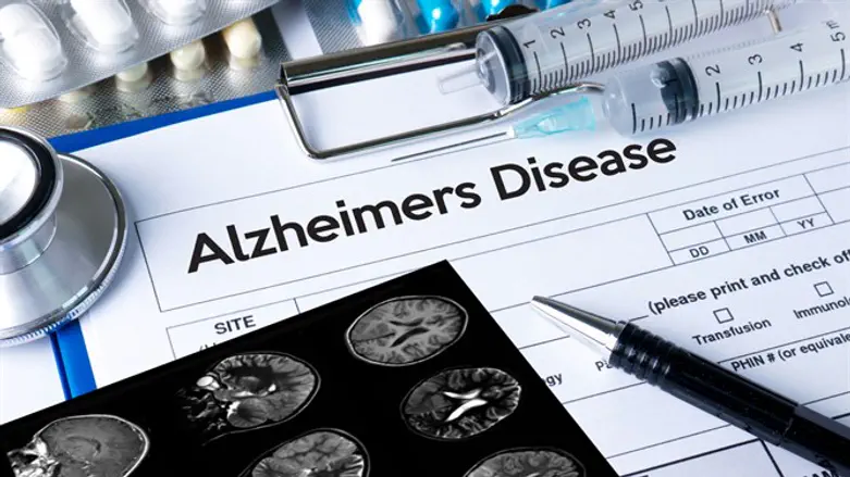 Alzheimer's disease