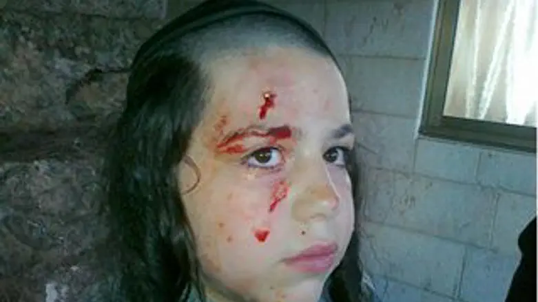 הילד הפצוע הערב בשמעון הצדיק