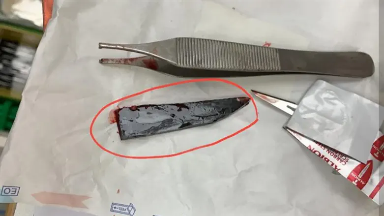 Инородное тело