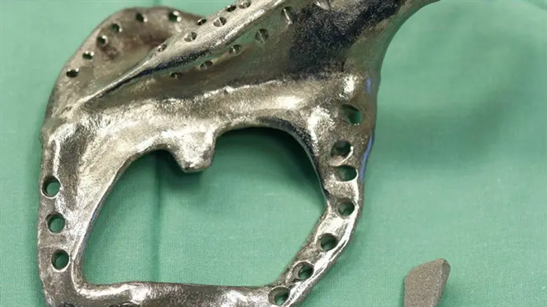 משתל טיטניום