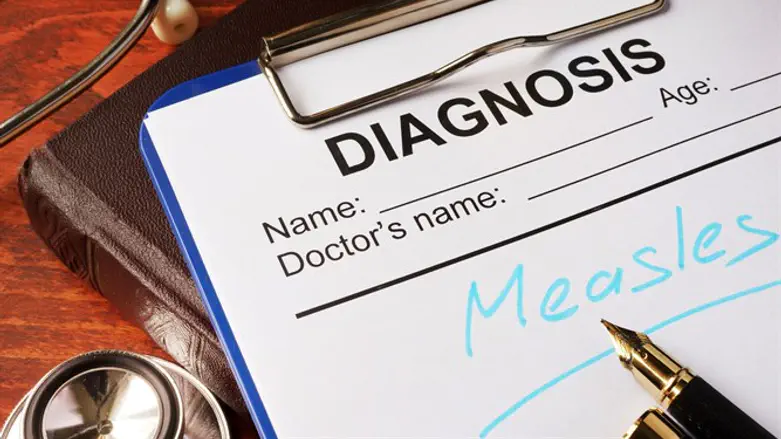 Диагноз - корь