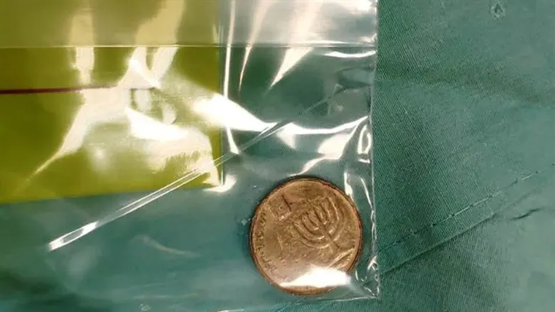 אחת המטבעות שהוצאו בניתוח