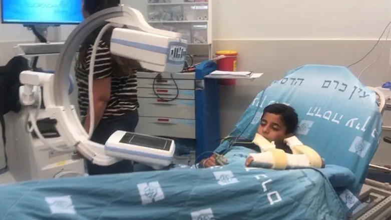 רום עם הגבס במכשיר השיקוף