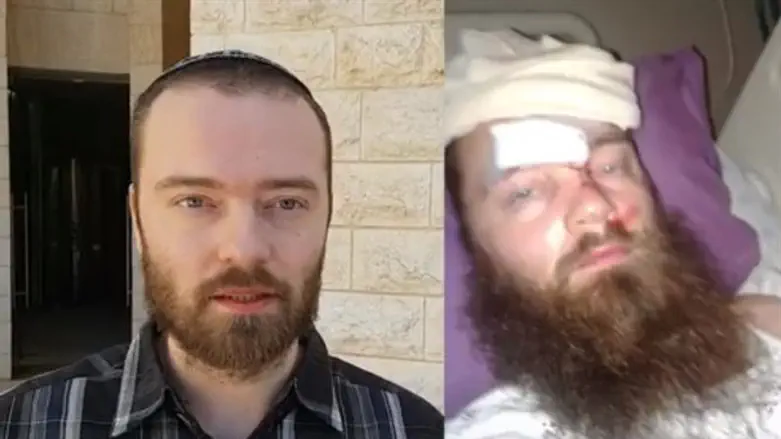 אלקיים לאחר הדריסה, והיום