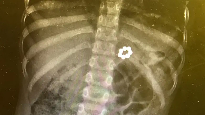 החוכמה היא להתאים טיפול למקרה